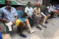 Artificial Limb Fitment Camp In Dhaka, Bangladesh