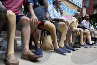 Artificial Limb Fitment Camp In Dhaka, Bangladesh
