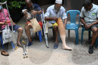 Artificial Limb Fitment Camp In Dhaka, Bangladesh