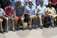 Artificial Limb Fitment Camp In Dhaka, Bangladesh