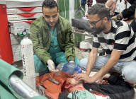 Gaza casualties injured in Israeli attacks
