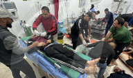 Gaza casualties injured in Israeli attacks