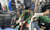 Gaza casualties injured in Israeli attacks