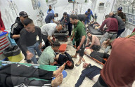 Gaza casualties injured in Israeli attacks