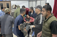 Gaza casualties injured in Israeli attacks