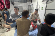 Gaza casualties injured in Israeli attacks