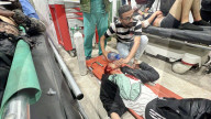 Gaza casualties injured in Israeli attacks