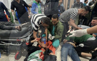 Gaza casualties injured in Israeli attacks