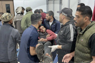 Gaza casualties injured in Israeli attacks
