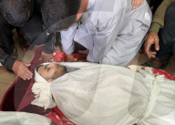 Gaza wounded and dead in hospital