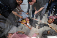 Gaza wounded and dead in hospital