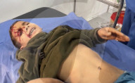 Gazan victims of Israeli regugee camp bombing