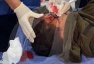Gazan victims of Israeli regugee camp bombing