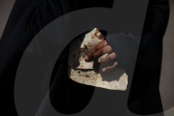 Severe food shortage in Gaza