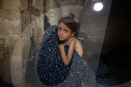 Malnutrition Emergency In Gaza