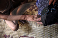 Malnutrition Emergency In Gaza