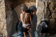 Malnutrition Emergency In Gaza