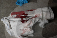 60-year-old Man And 40-year-old Man Stabbed At 144 Nagle Avenue