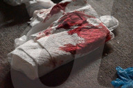 60-year-old Man And 40-year-old Man Stabbed At 144 Nagle Avenue