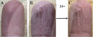 Do fingers in water always wrinkle the same way