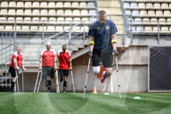 Ukraine war veterans hold amputee football training session