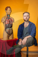 Will Rees: I found myself Googling: can brain cancer cause hiccups? How I fell into a hypochondriac rabbit hole.