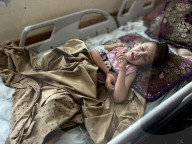 Wounded Gaza children in hospital