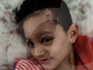 Wounded Gaza children in hospital