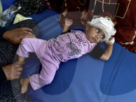 Wounded Gaza children in hospital