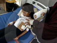 Wounded Gaza children in hospital