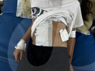 Wounded Gaza children in hospital