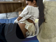Wounded Gaza children in hospital