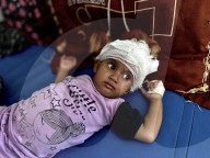 Wounded Gaza children in hospital