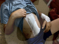 Wounded Gaza children in hospital