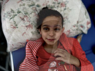 Wounded Gaza children in hospital