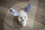 AviadoBio the UK lab working on a way to halt genetic type of dementia.