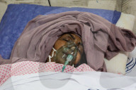 Iranian victims of Israeli air strikes in hospital