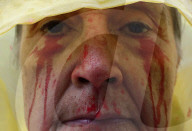 Blood Protest Against Israel