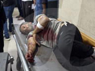Killed and wounded Palestinians, after the Israeli attack, are being brought to Nasser hospitalGazans wounded after Israeli attack