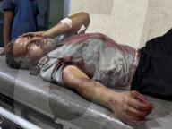 Killed and wounded Palestinians, after the Israeli attack, are being brought to Nasser hospitalGazans wounded after Israeli attack