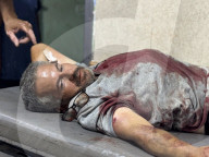 Killed and wounded Palestinians, after the Israeli attack, are being brought to Nasser hospitalGazans wounded after Israeli attack