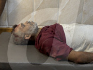 Killed and wounded Palestinians, after the Israeli attack, are being brought to Nasser hospitalGazans wounded after Israeli attack