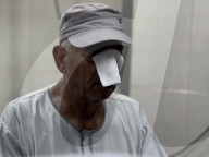Killed and wounded Palestinians, after the Israeli attack, are being brought to Nasser hospitalGazans wounded after Israeli attack