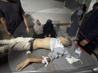 Killed and wounded Palestinians, after the Israeli attack, are being brought to Nasser hospitalGazans wounded after Israeli attack