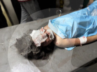 Killed and wounded Palestinians, after the Israeli attack, are being brought to Nasser hospitalGazans wounded after Israeli attack