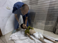 Gaza man dies of severe malnutrition