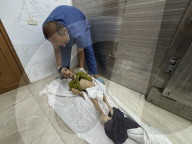 Gaza man dies of severe malnutrition