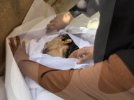 Gaza man dies of severe malnutrition
