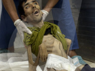 Gaza man dies of severe malnutrition