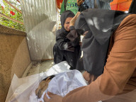 Gaza man dies of severe malnutrition